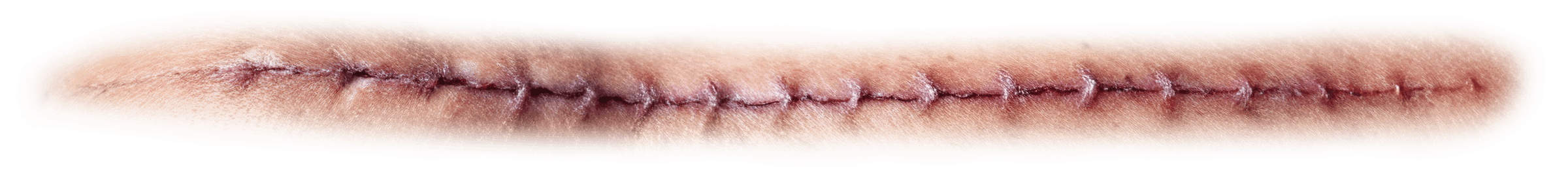 Stitches PNG