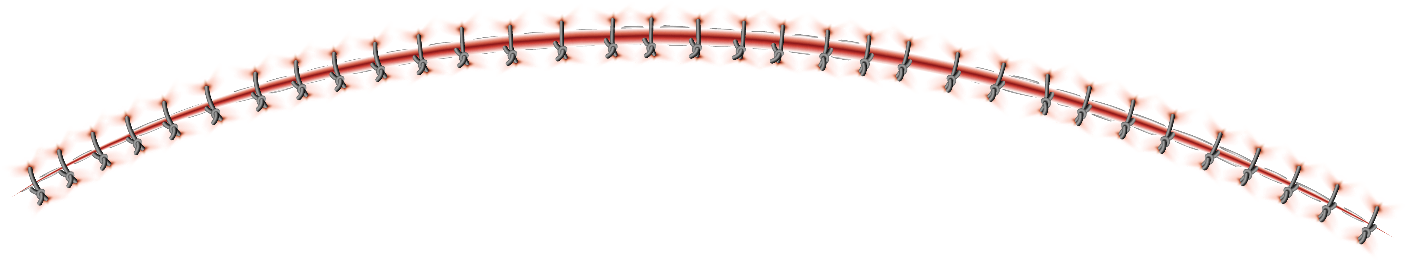 Stitches PNG Transparent Stitches PNG Transparent